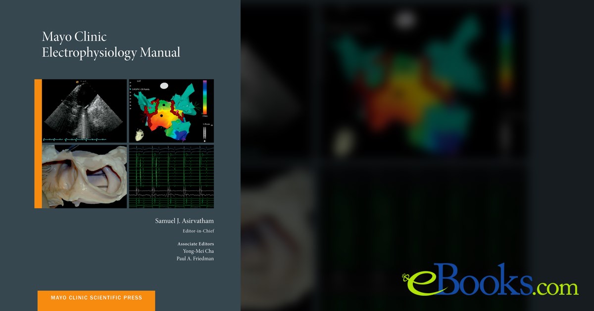 Mayo Clinic Electrophysiology Manual by Samuel J. Asirvatham (ebook)