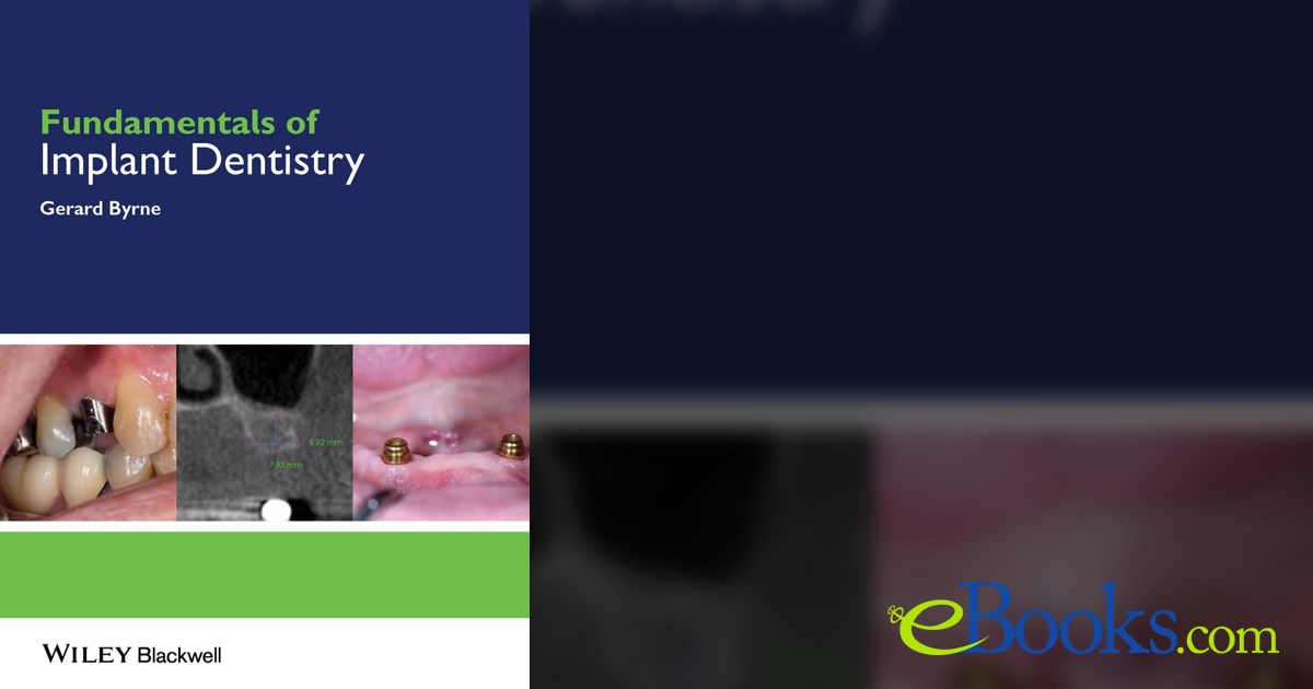 Fundamentals of Implant Dentistry by Gerard Byrne (ebook)