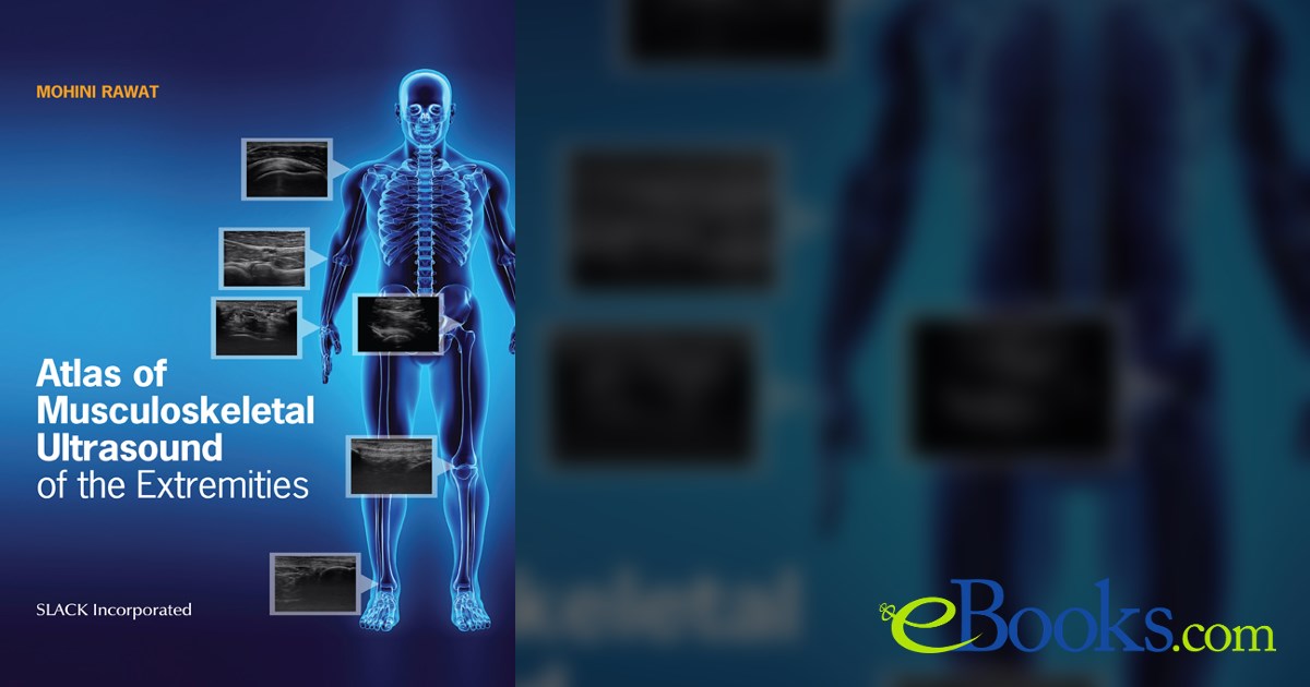 Atlas of Musculoskeletal Ultrasound of the Extremities