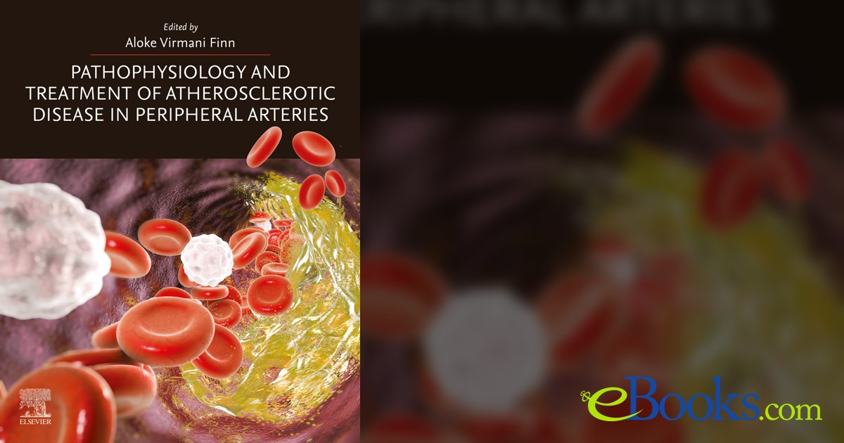 Pathophysiology and Treatment of Atherosclerotic Disease in Peripheral ...