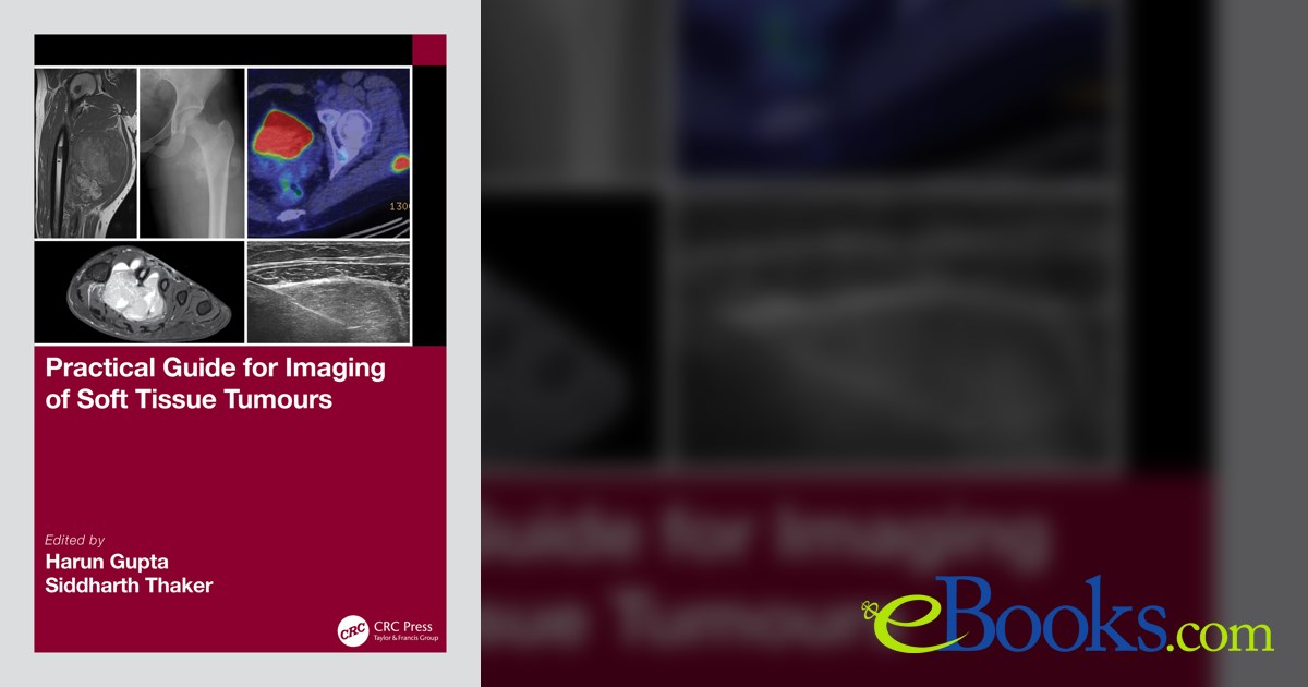 Practical Guide for Imaging of Soft Tissue Tumours