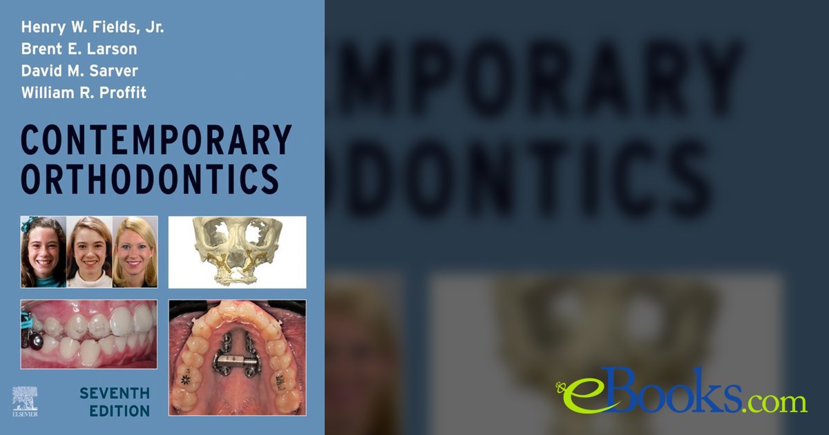 PROFFIT/CONTENMPORARY ORTHODONTICS/fifth The Etiology of 
