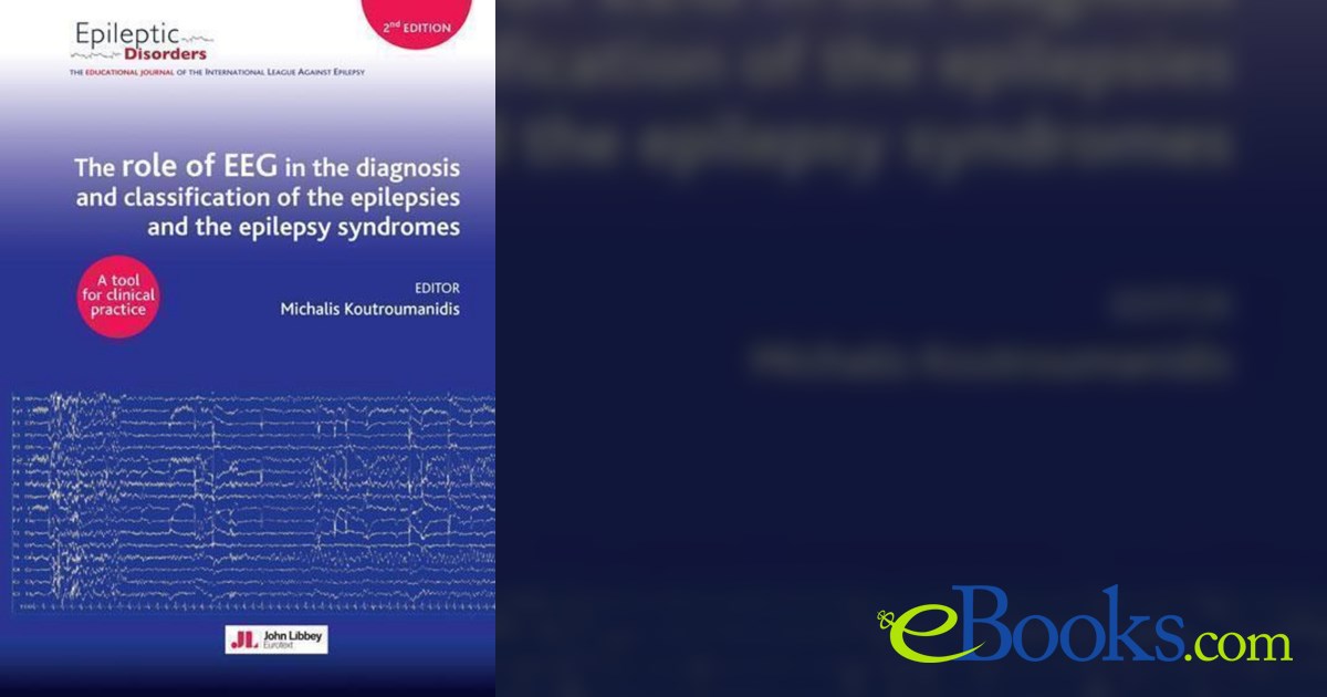 The role of EEG in the diagnosis and classification of the epilepsies ...