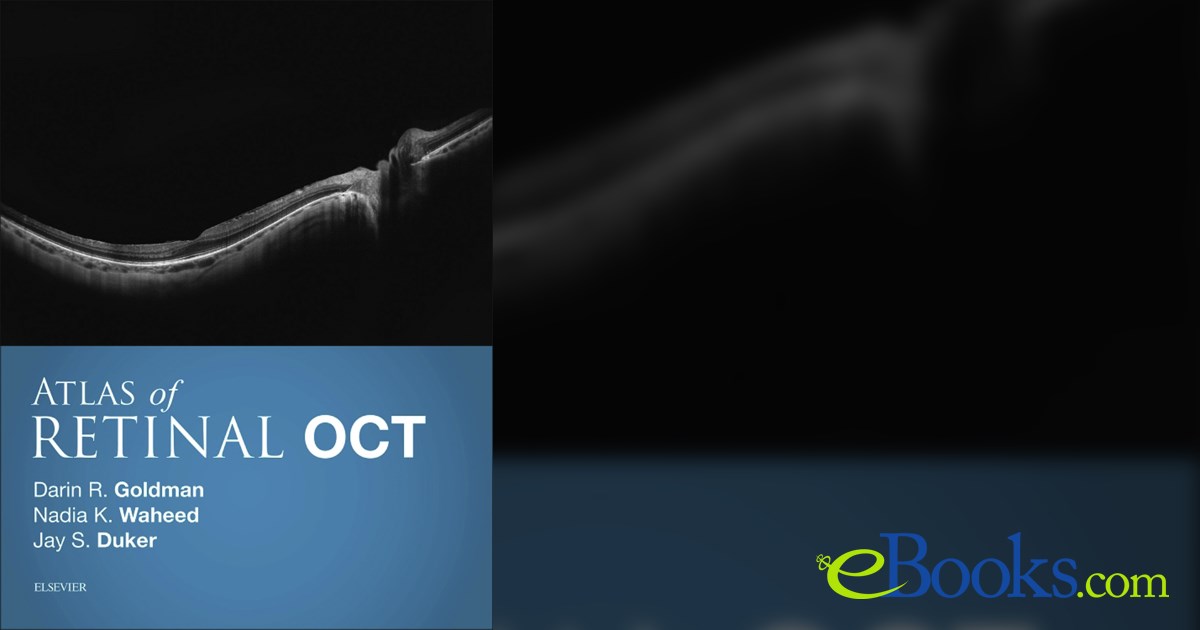 Atlas of Retinal OCT E-Book by Darin Goldman MD (ebook)