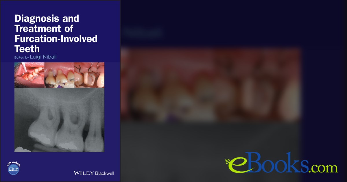 Diagnosis and Treatment of Furcation-Involved Teeth