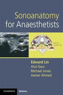 Book cover: Sonoanatomy for Anaesthetists, by Edward Lin (preview)