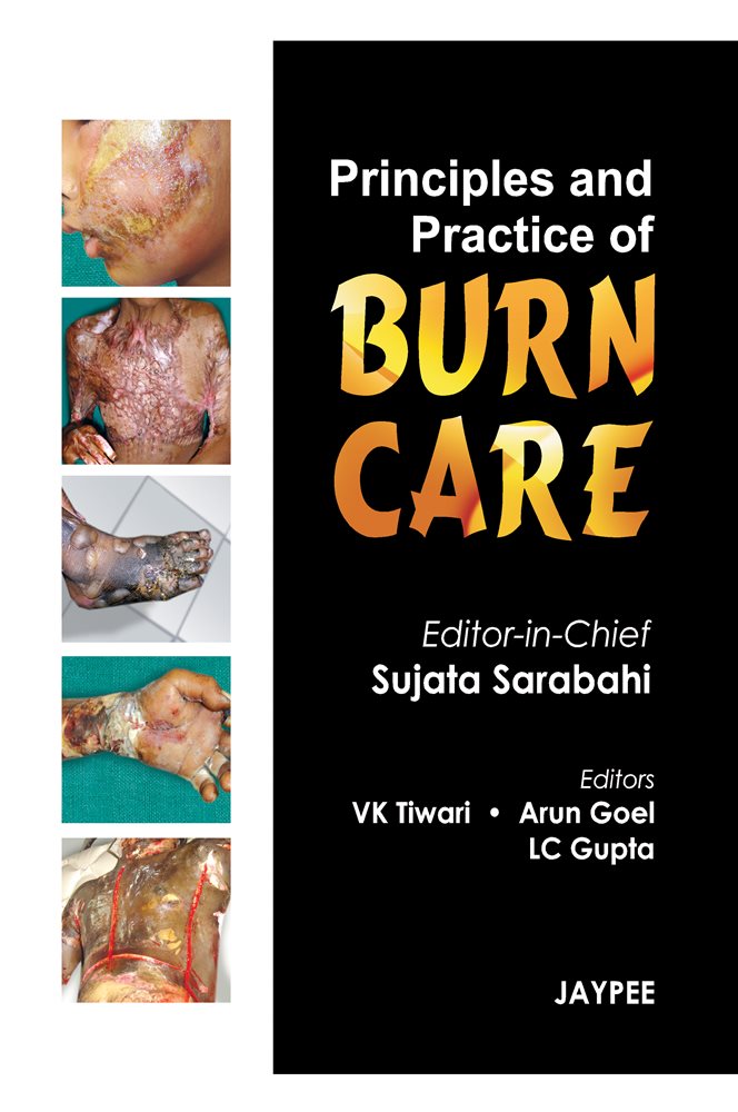 Principles And Practice Of Burn Care by Sarabahi Sujata (ebook)