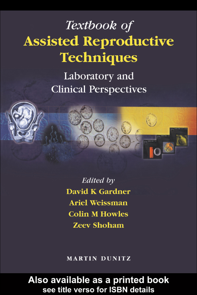 Textbook Of Assisted Reproductive Techniques