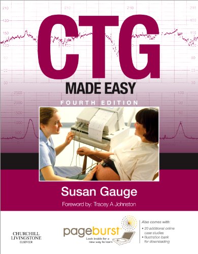 CTG Made Easy E-Book