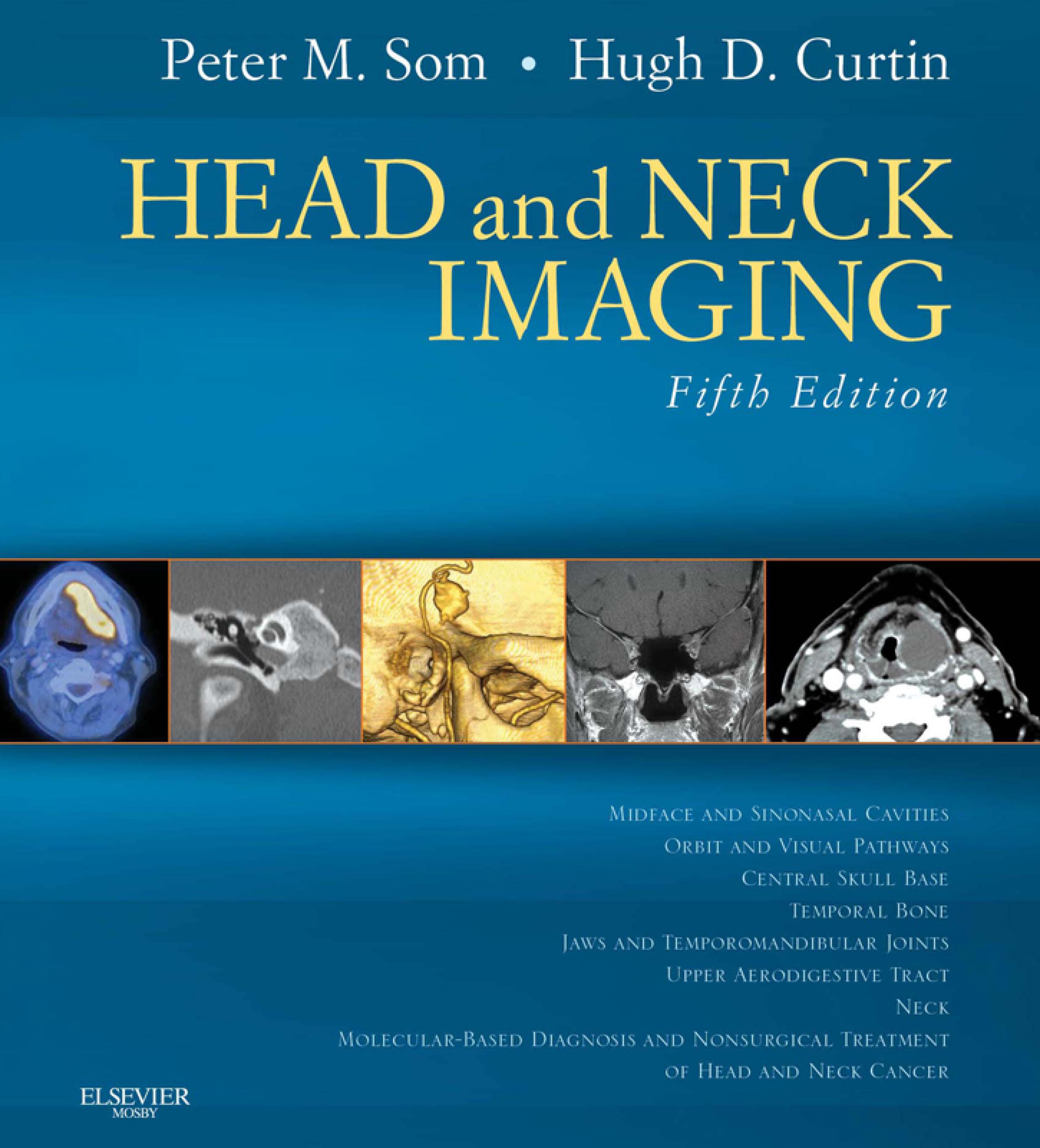 Elsevier Head and Neck Imaging Fifth Edition Volume 1 2011 PeterM.Som・HughD.Curtin 080LaD Head and Neck Imaging E-Book (5th ed.) by Peter M. Som MD