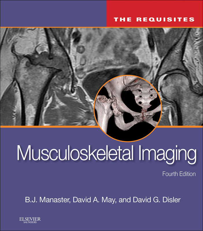 Musculoskeletal Imaging: The Requisites E-Book (4th ed.)