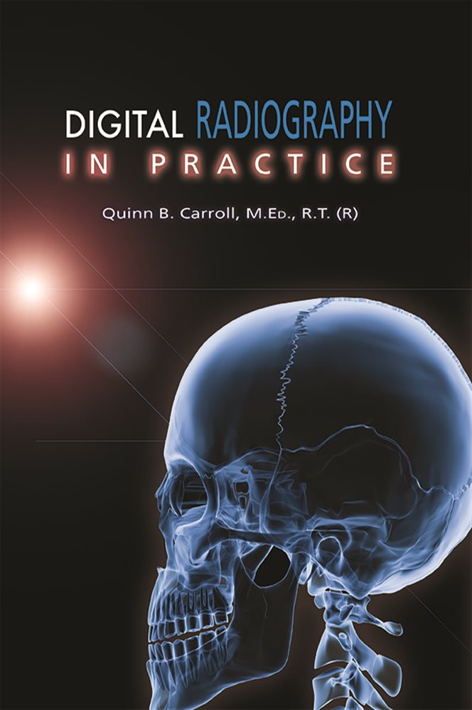 Digital Radiography in Practice by Quinn B. Carroll (ebook)