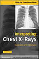 Book cover: Interpreting Chest X-Rays, by Philip Eng (preview)