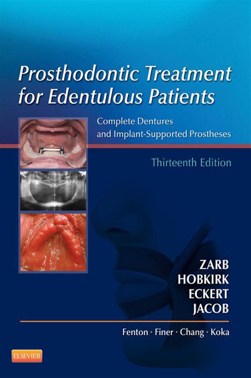 Prosthodontic Treatment for Edentulous Patients (13th ed.)