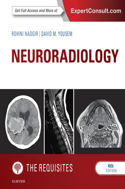 Neuroradiology: The Requisites (4th ed.) by Rohini Nadgir (ebook)