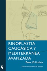 Rinoplastia Cauc&amp;&#xE1;sica y Mediterr&amp;&#xE1;nea Avanzada