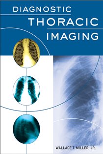 Book cover: Diagnostic Thoracic Imaging, by Wallace T. Miller (preview)