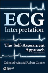 Book cover: ECG Interpretation, by Zainul Abedin (preview)