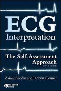 Book cover: ECG Interpretation, by Zainul Abedin (preview)
