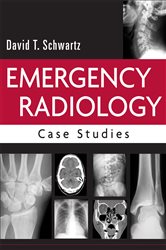 Book cover: Emergency Radiology: Case Studies, by David T. Schwartz (preview)