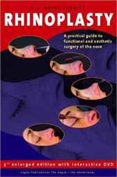 Rhinoplasty - Book (3rd enlarged edition): A practical guide to functional and aesthetic surgery of the nose
