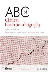 Book cover: ABC of Clinical Electrocardiography, edited by Francis Morris (preview)