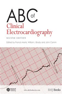 Book cover: ABC of Clinical Electrocardiography, edited by Francis Morris (preview)