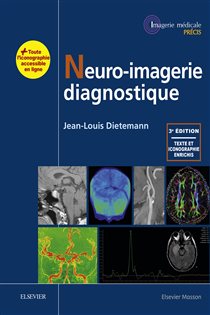Book cover: Neuro-imagerie diagnostique, by Jean-Louis Dietemann (preview)