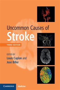 Book cover: Uncommon Causes of Stroke, edited by Louis Caplan (preview)