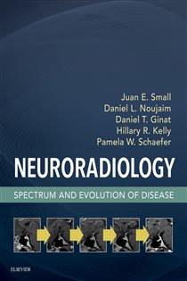 Book cover: Neuroradiology, by Small MD, MSc, Juan E. (preview)