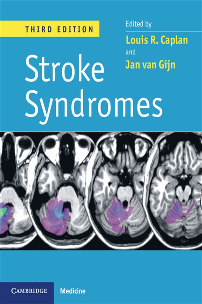 Stroke Syndromes, 3ed (3rd ed.) by Louis R. Caplan (ebook)