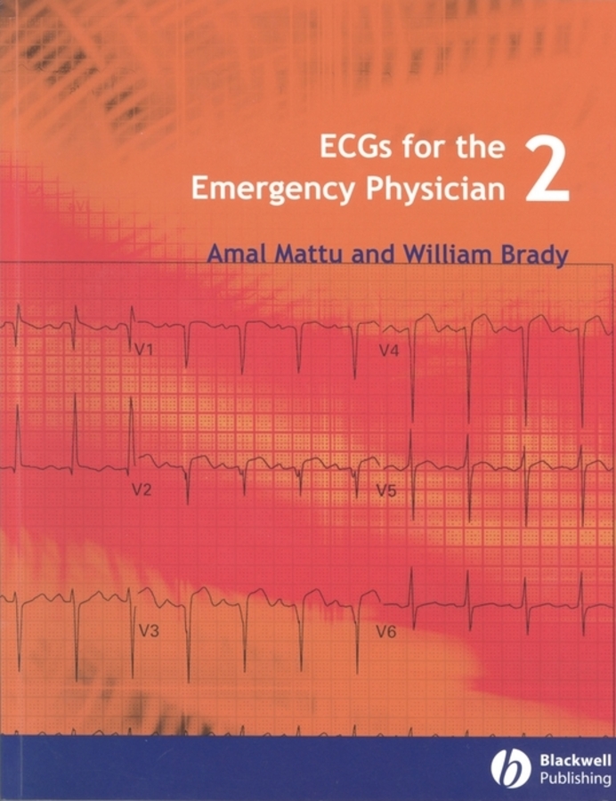ECGs for the Emergency Physician 2 - 50-99.99