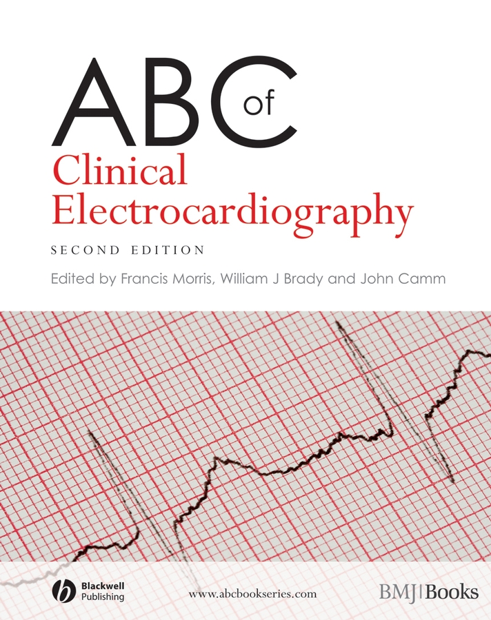 ABC of Clinical Electrocardiography - 50-99.99