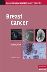 Breast Cancer - 