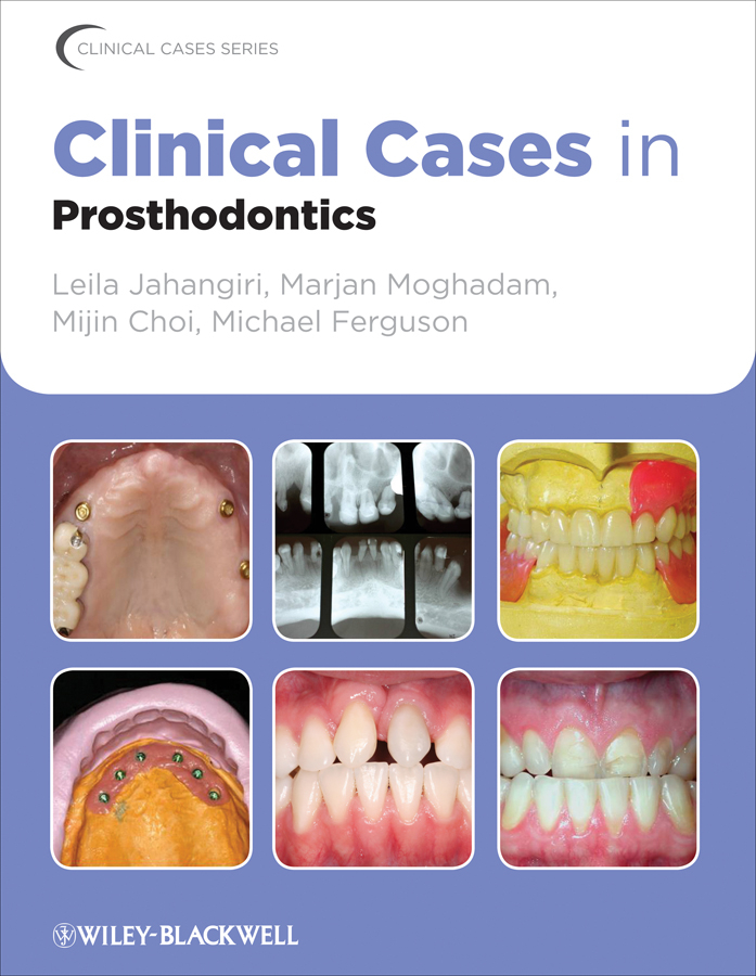 Clinical Cases in Prosthodontics - 50-99.99