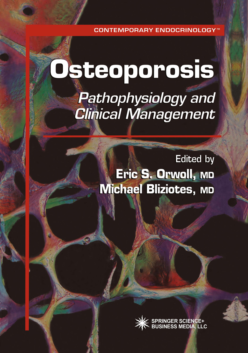 Osteoporosis - 50-99.99
