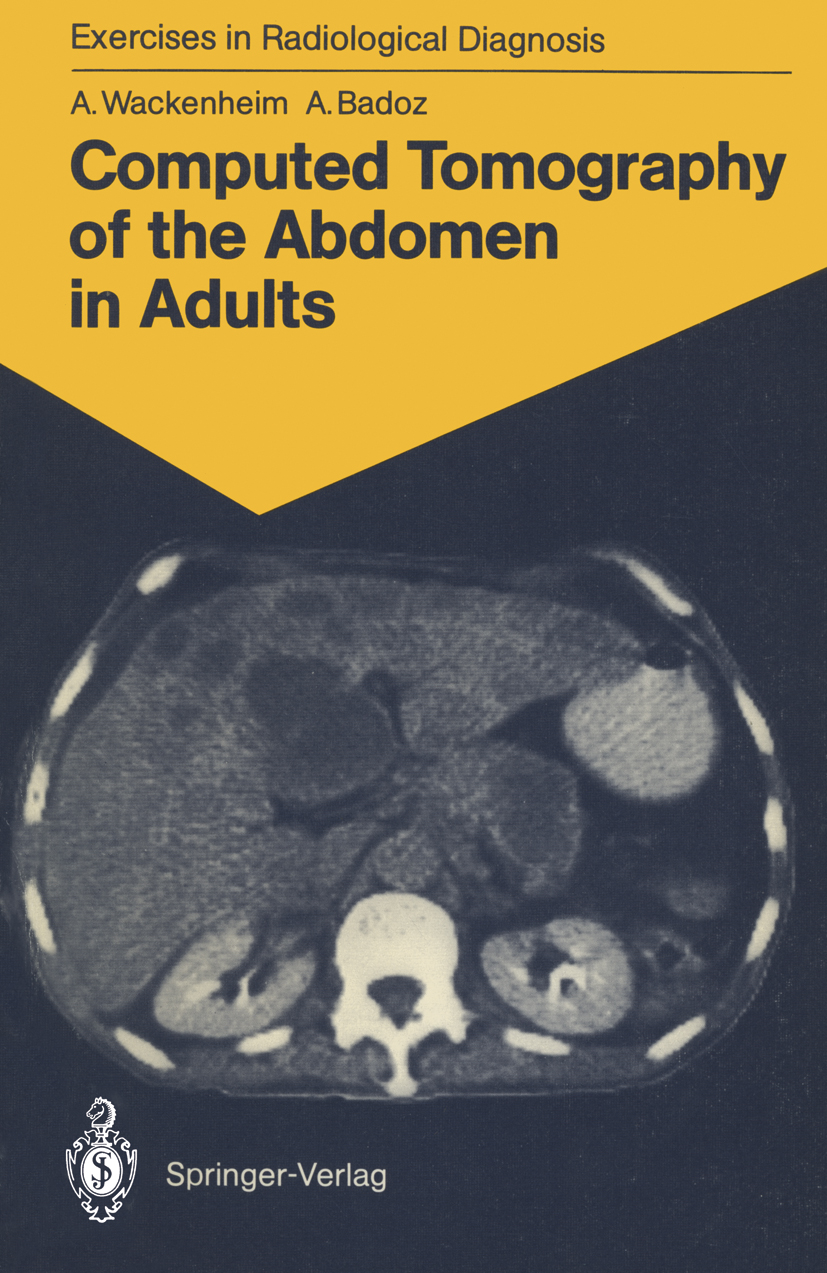 Computed Tomography of the Abdomen in Adults - >100