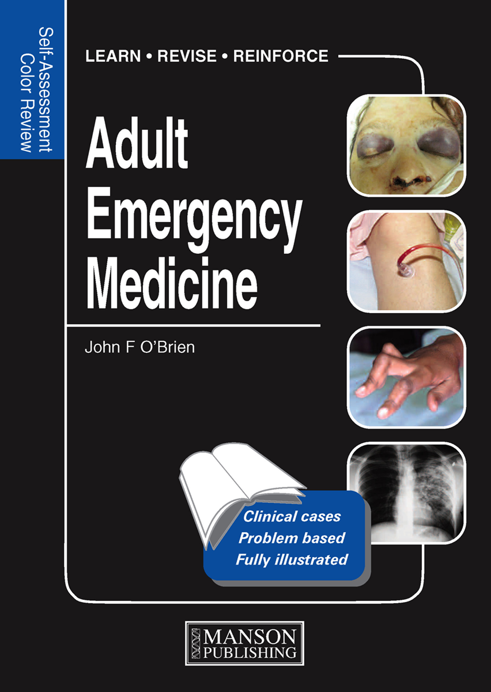 Adult Emergency Medicine - 25-49.99