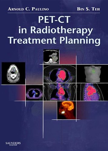 PET-CT in Radiotherapy Treatment Planning E-Book - 50-99.99