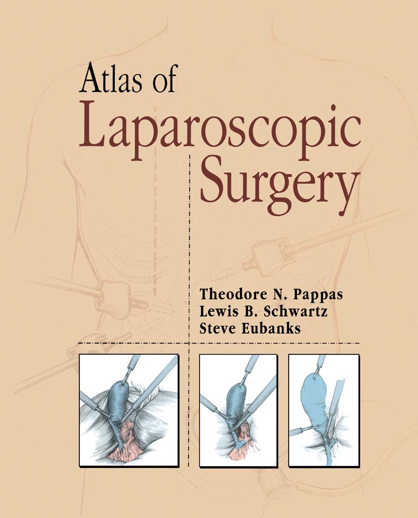 ISBN 9781475793161 product image for Atlas of Laparoscopic Surgery | upcitemdb.com