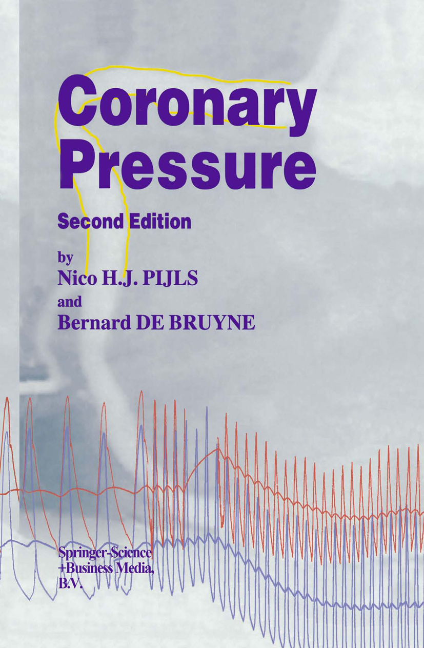 Coronary Pressure - >100