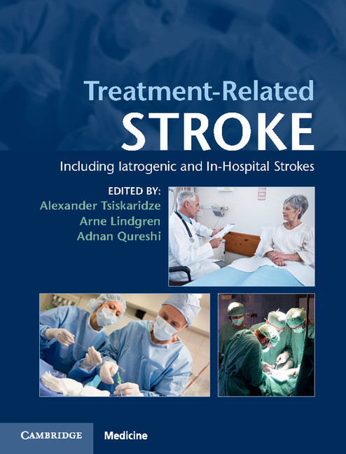 Treatment-Related Stroke Treatment-Related Stroke