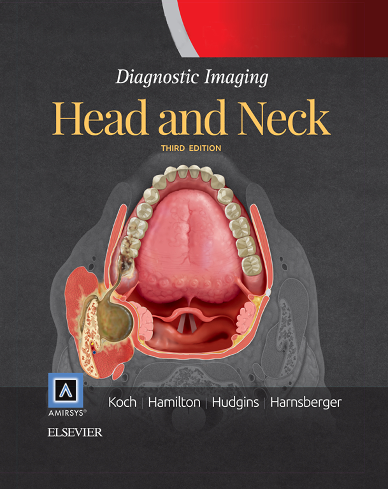 Diagnostic Imaging: Head and Neck E-Book (3rd ed.)
