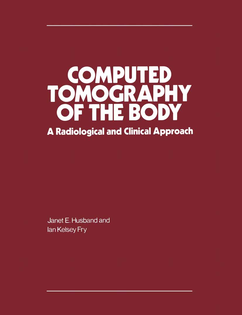 Computed Tomography of the Body - 25-49.99
