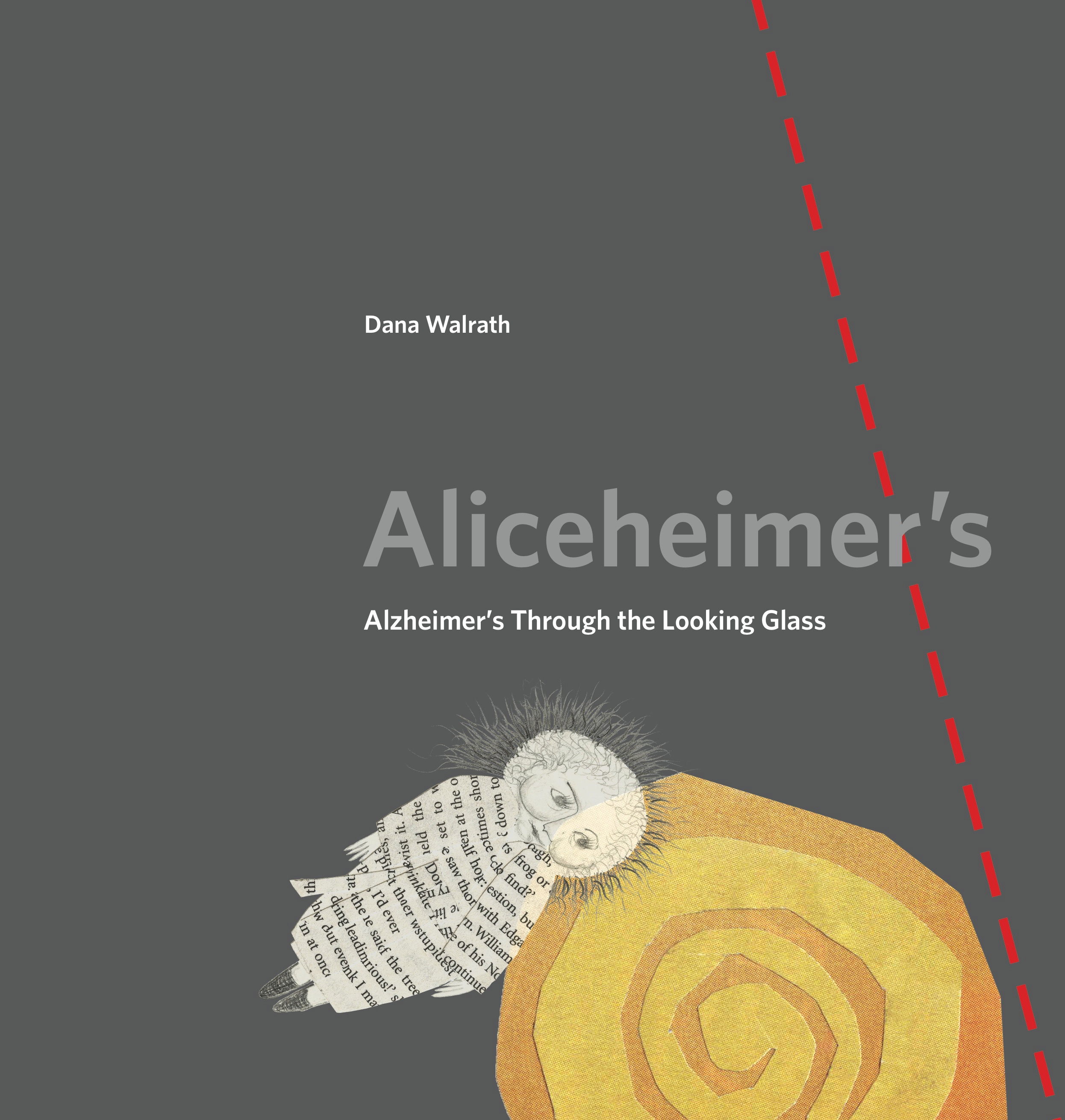 Aliceheimer’s Aliceheimer’s